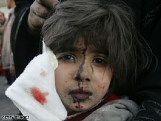 ガザ空爆の死者225人に 市民の死傷者多数